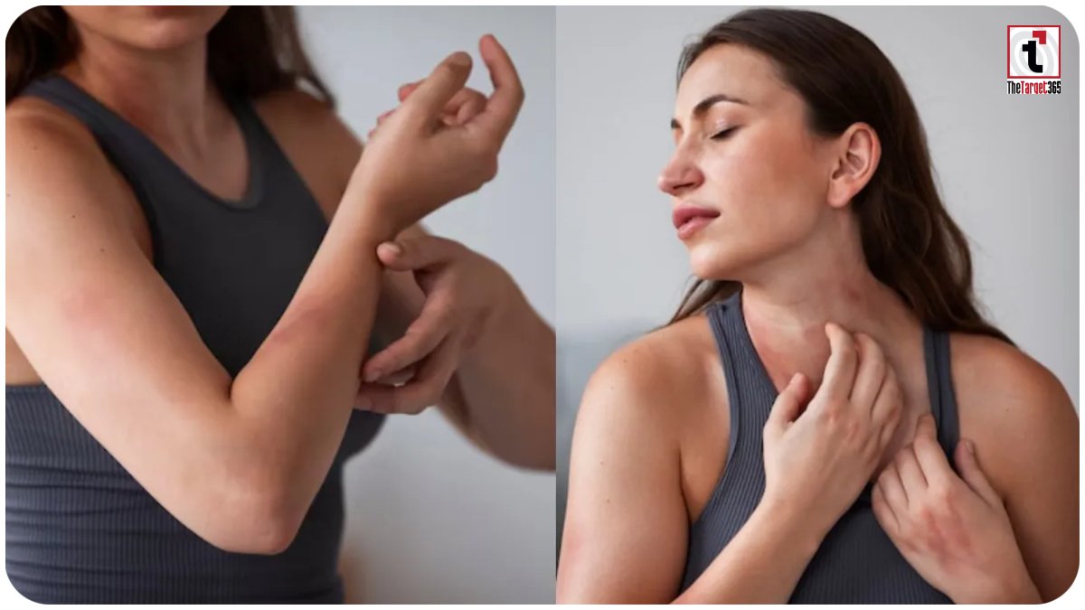 Skin Itching Secrets