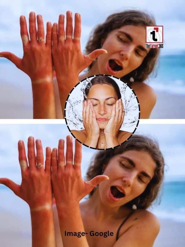 बढ़ती गर्मी में ऐसे रखें अपनी त्वचा का ख्याल