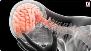 Cervical Pain and Brain