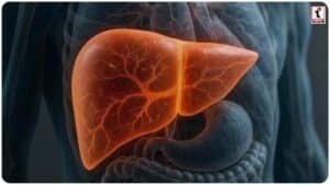 Liver Cirrhosis