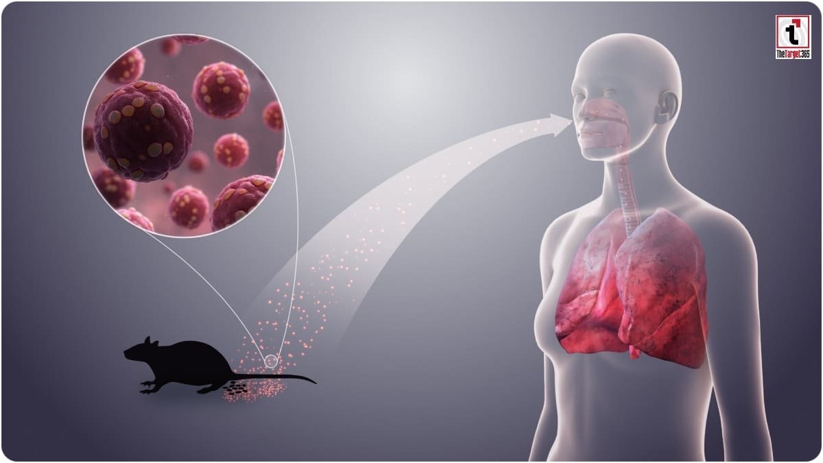 Hantavirus Symptoms