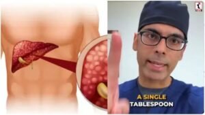Fatty Liver Diet