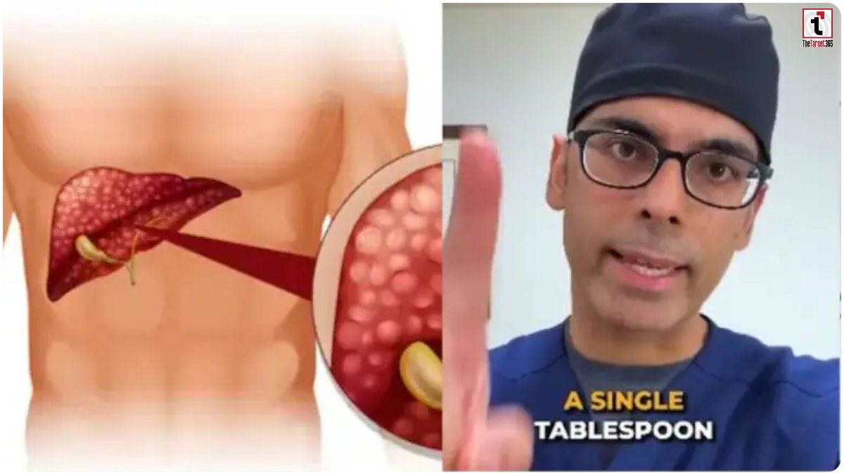 Fatty Liver Diet