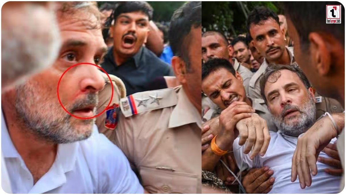 Rahul Gandhi Injured