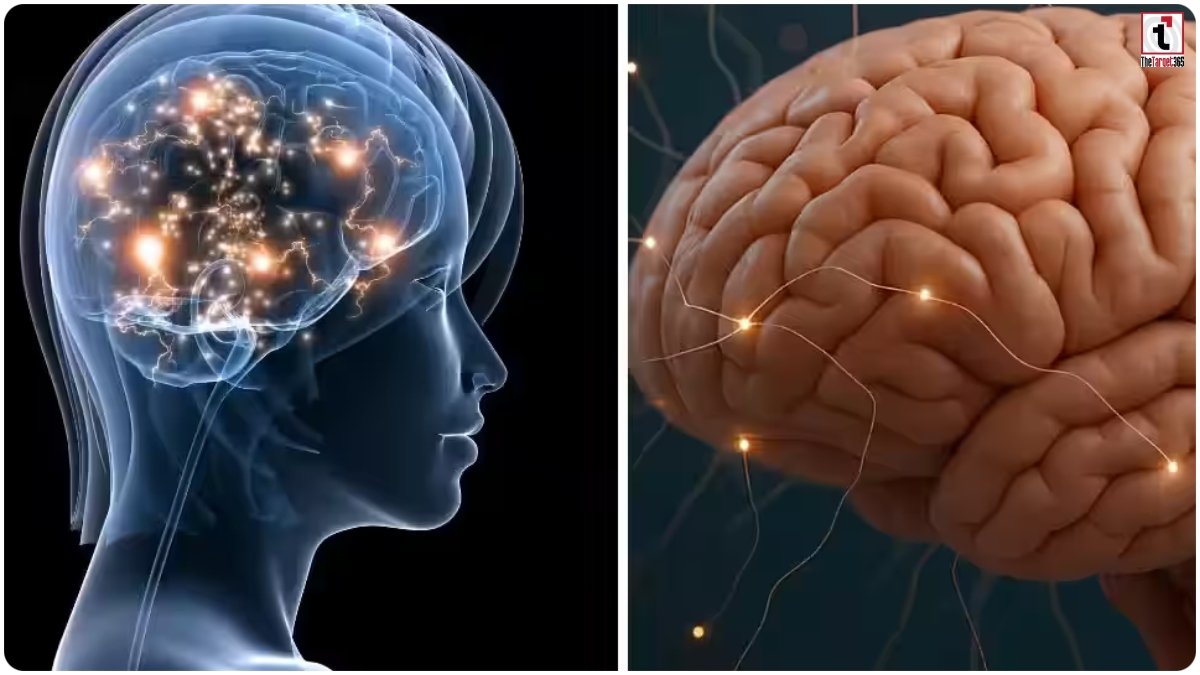 Brain Health