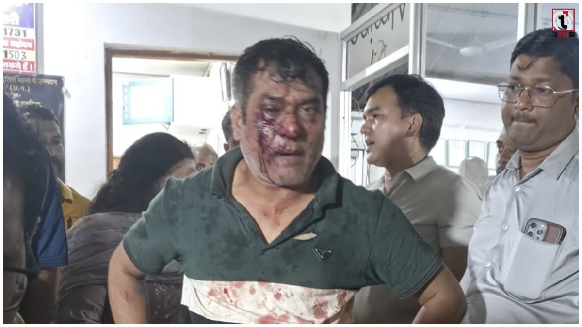 Congress Leader Attack