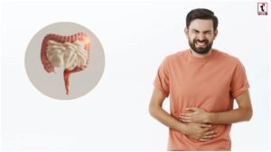 Sensitive Gut Foods