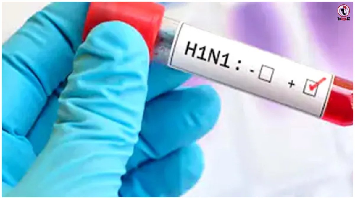 UP Swine Flu