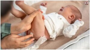 Diaper Rash