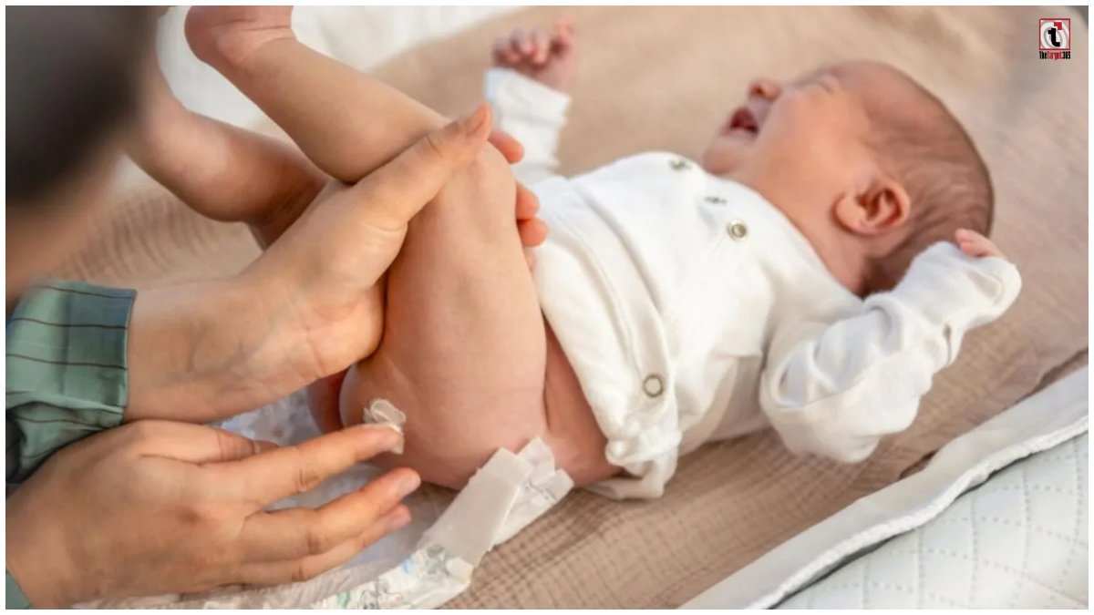 Diaper Rash