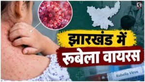 Jharkhand Rubella Virus