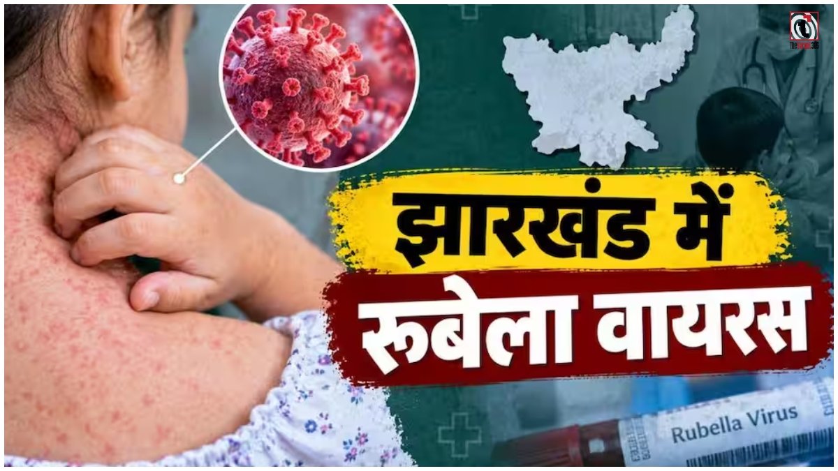 Jharkhand Rubella Virus
