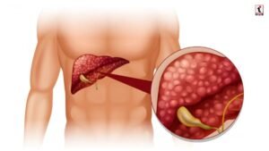 Liver Detox