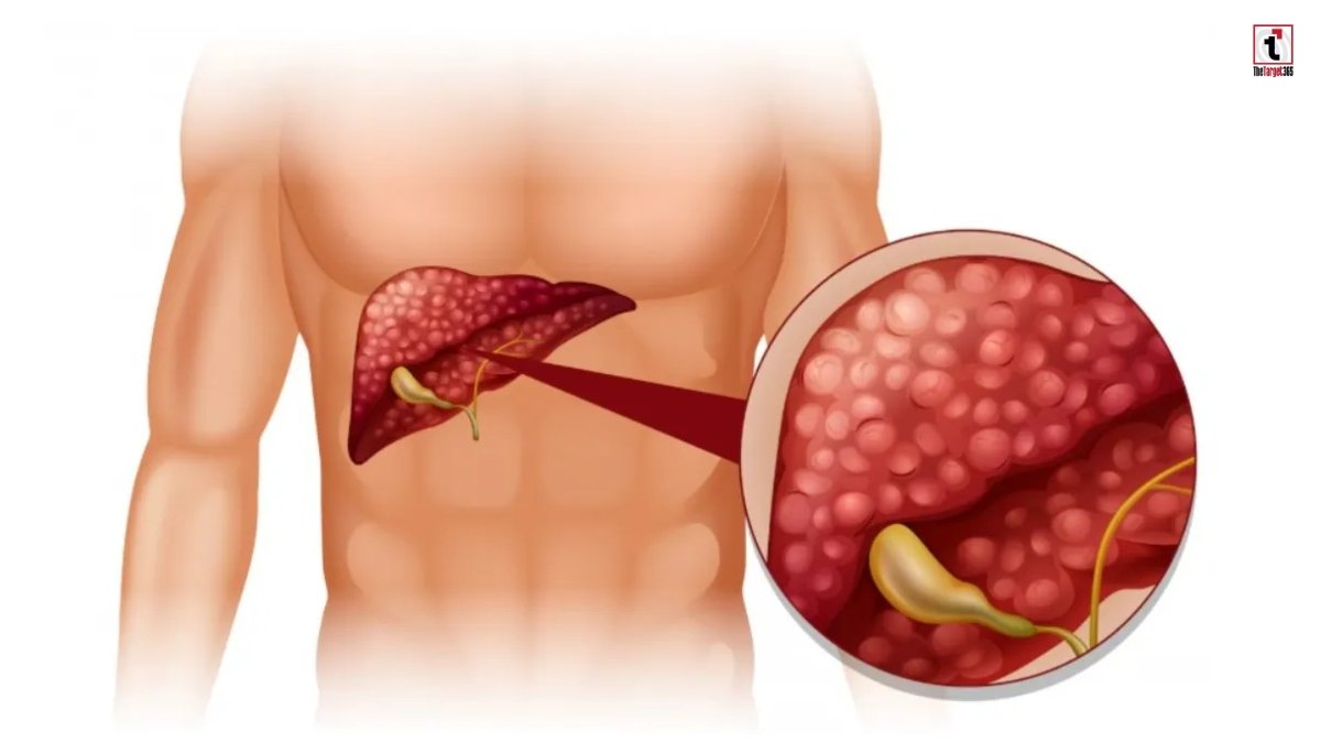 Liver Detox