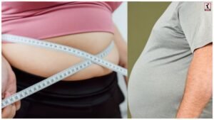 Obesity Health Risks
