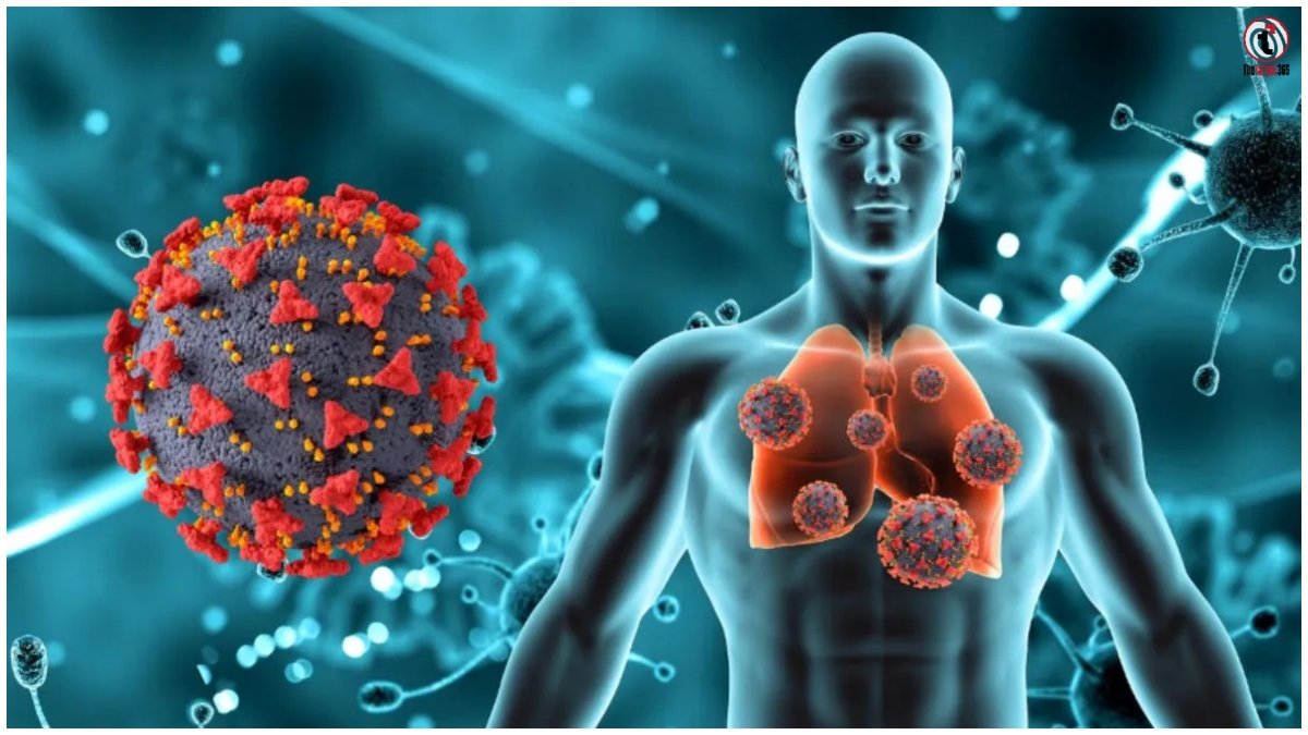 Swine Flu Pneumonia