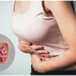 Colon Cancer Symptoms
