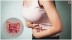 Colon Cancer Symptoms