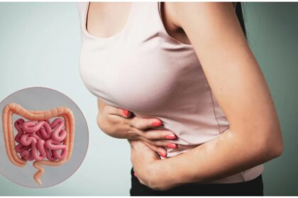 Colon Cancer Symptoms