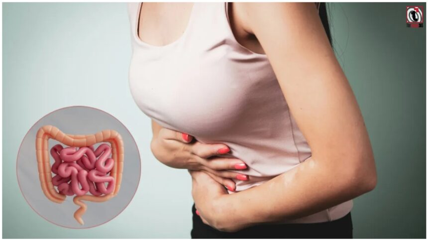 Colon Cancer Symptoms