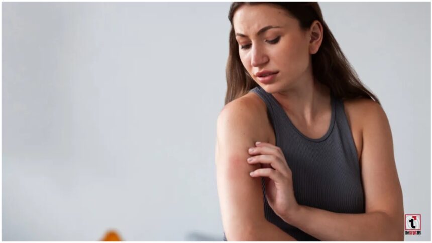 Itching Skin Symptoms