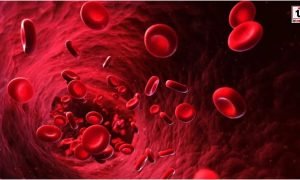 Anemia in Children :