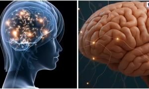 Brain Health