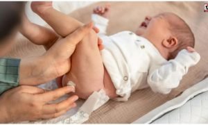 Diaper Rash