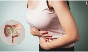 Gut Health Foods