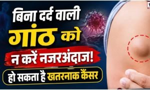 Health Alert