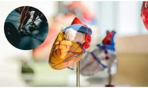 Heart Patients Exercise