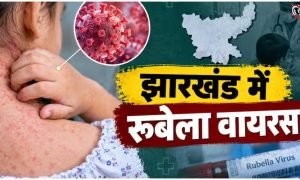 Jharkhand Rubella Virus