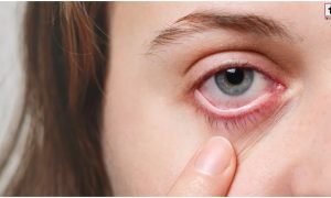 Monsoon Eye Care