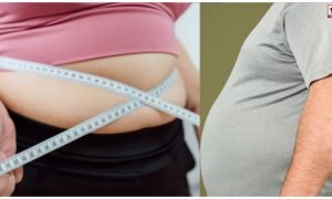 Obesity Health Risks