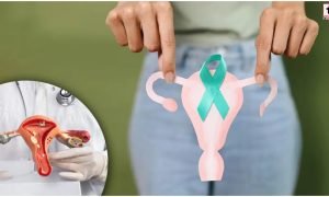 Cervical Cancer India