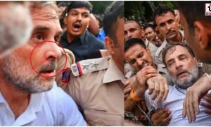 Rahul Gandhi Injured