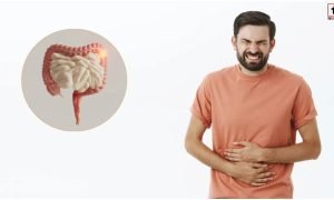 Sensitive Gut Foods