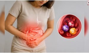Vitamin B12