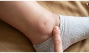 Water Retention